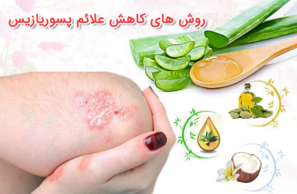  داروی پسوریازیس تناسلی