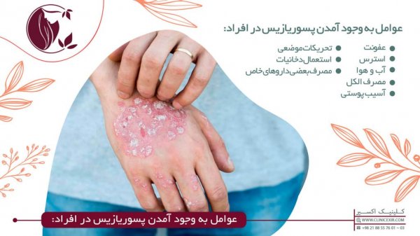  آیا پسوریازیس باعث چاق شدن میشود؟