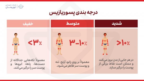  جلوگیری از پیشرفت پسوریازیس