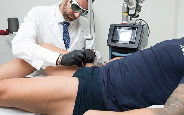 سوزاندن زگیل تناسلی در مردان + سوزاندن زگیل تناسلی با هویه