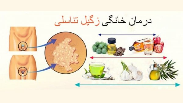  سوزاندن زگیل تناسلی در مردان + سوزاندن زگیل تناسلی با هویه