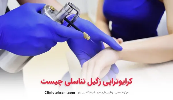 نحوه کرایو زگیل تناسلی