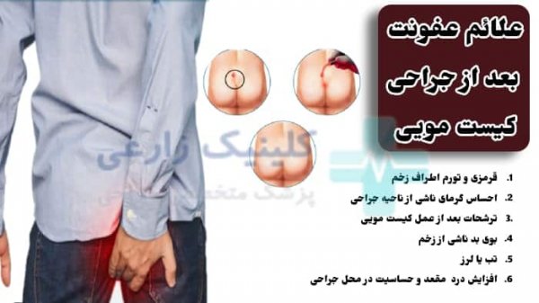  عکس عفونت کیست مویی بعد از عمل