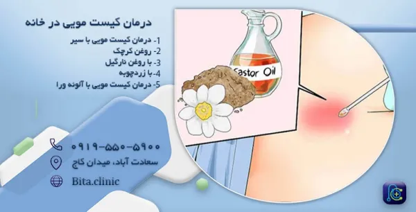  کیست مویی چه علائمی دارد؟