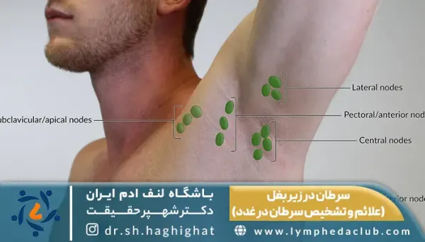  کیست زیر بغل چه علائمی دارد؟
