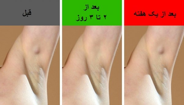  کیست زیر بغل چه علائمی دارد؟