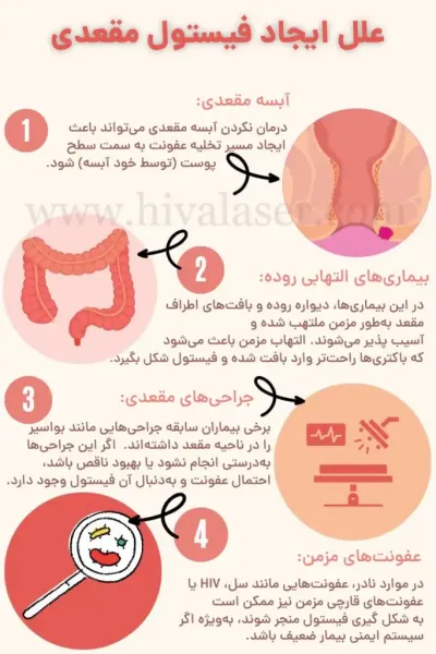  فیستول مقعدی چگونه به وجود می آید؟
