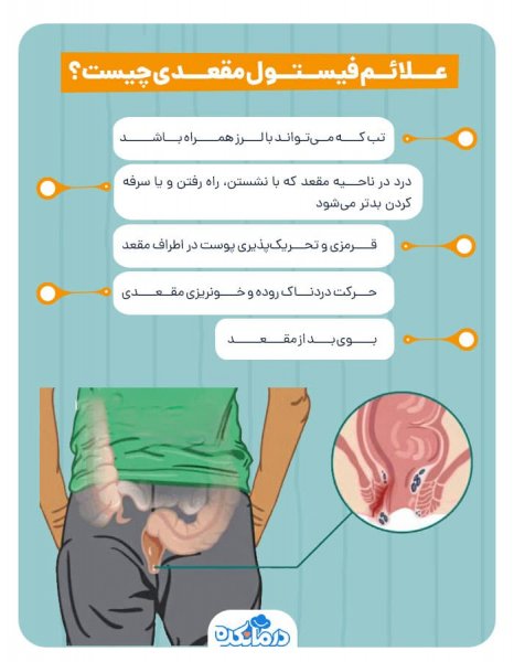  فیستول مقعدی چگونه به وجود می آید؟