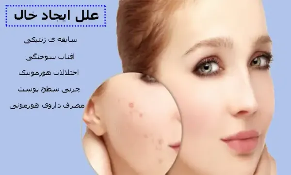  عکس زگیل صورت + انواع زگیل صورت + درمان