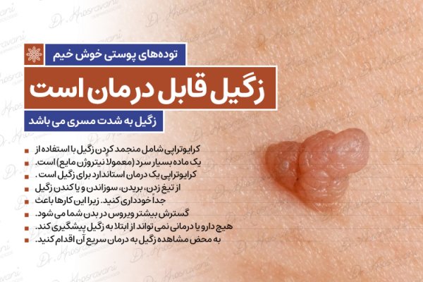  درمان زگیل صورت در طب سنتی + پماد زگیل صورت