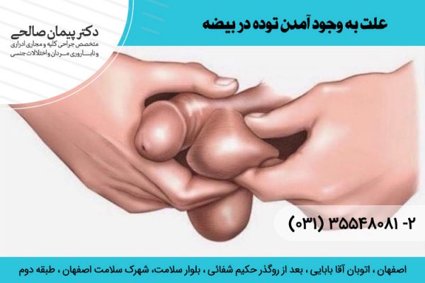 عکس توده سفت زیر پوست در ناحیه تناسلی مردان