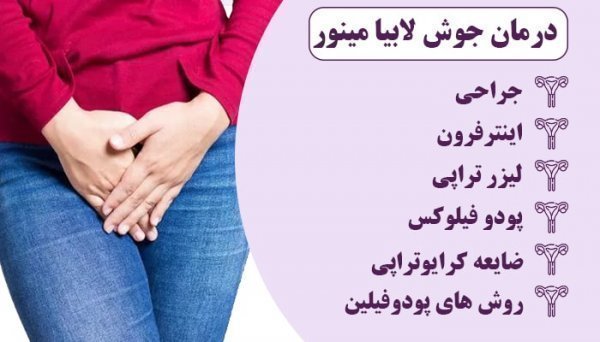  انواع غده در واژن + عکس