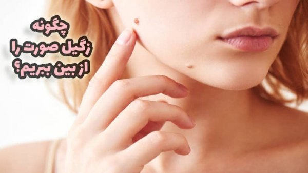 آیا زگیل صورت خطرناک است