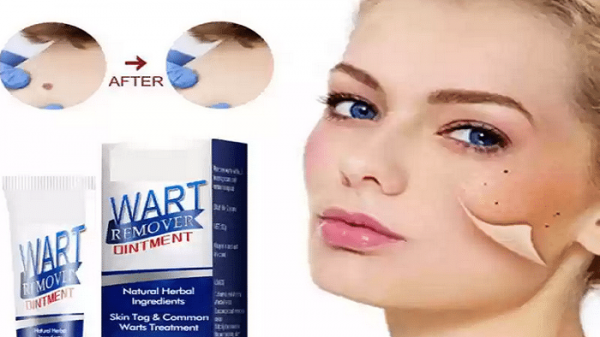  آیا زگیل صورت خطرناک است